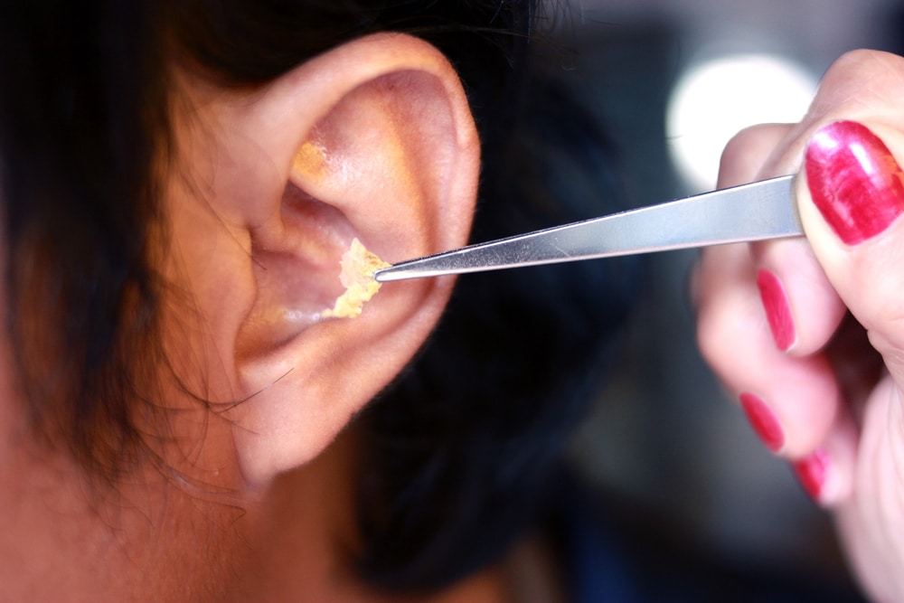 We Do Impacted Ear Wax Removal At Our Six Clinics - The Microsuction Ear  Wax Removal Network