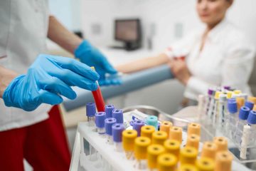 Regular blood testing benefits and what to expect during tests