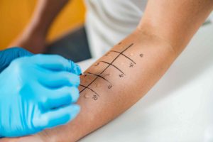 What are the different methods for allergy testing