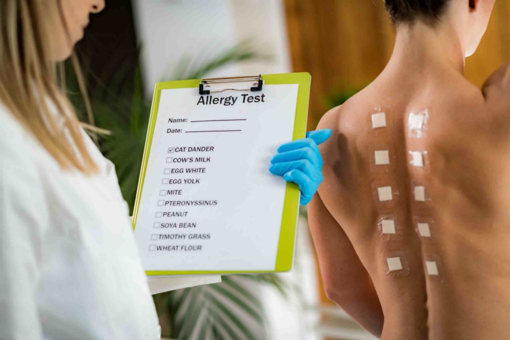 Allergy testing in northampton at touchwood pharmacy