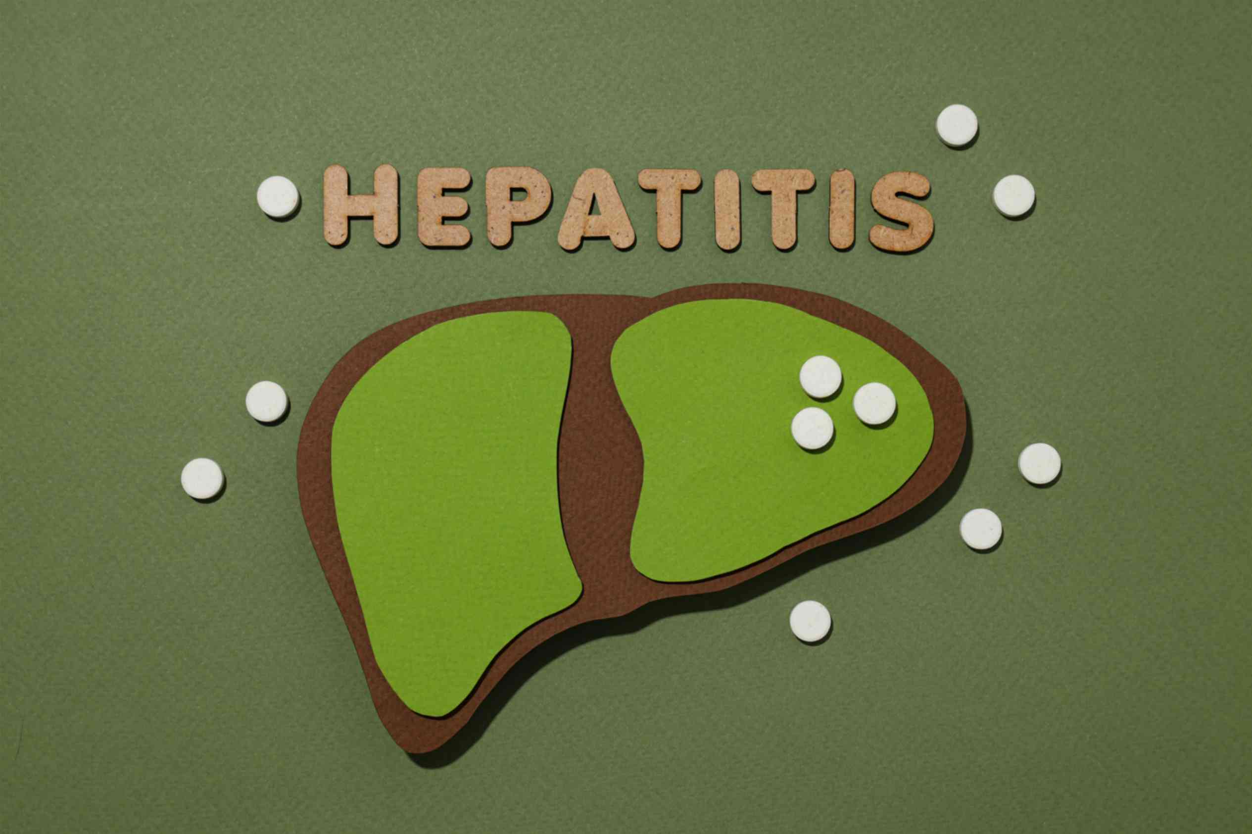 How-hepatitis-causes-jaundice-explained