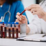 Fasting requirements for a diabetes blood test essential facts and guidelines