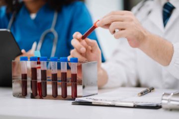 Fasting requirements for a diabetes blood test essential facts and guidelines